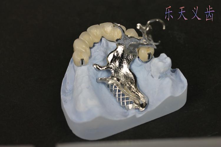 9000万颗假牙撑起一个IPO