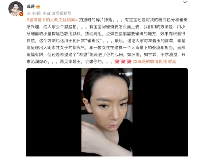 戚薇坦诚回应眼角上提：肉毒打多了！出道20年，她颜值变化到底有多大？