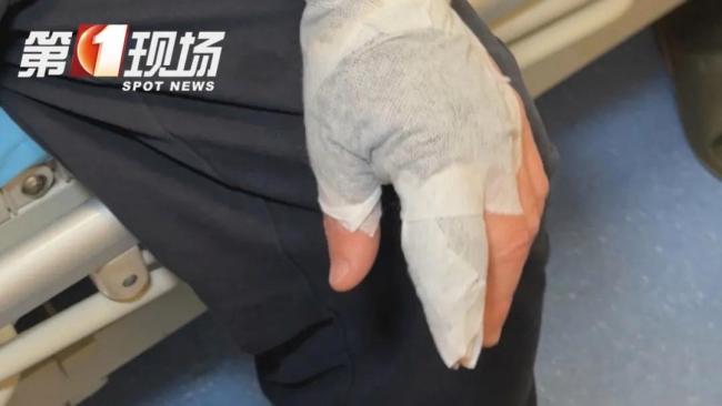 男子感染创伤弧菌险丧命 处理海鲜需谨慎